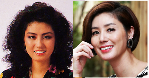 Kim Sun Ryung thẩm mỹ