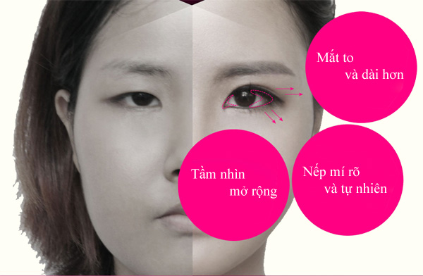 tại sao nên mở rộng khoé mắt