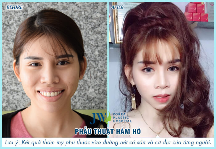 benh-vien-tham-my-4