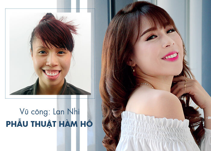 benh-vien-tham-my-6