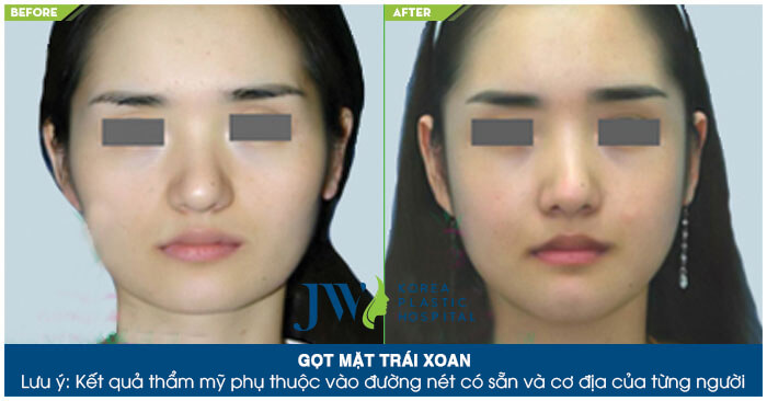 mat-trai-xoan-6
