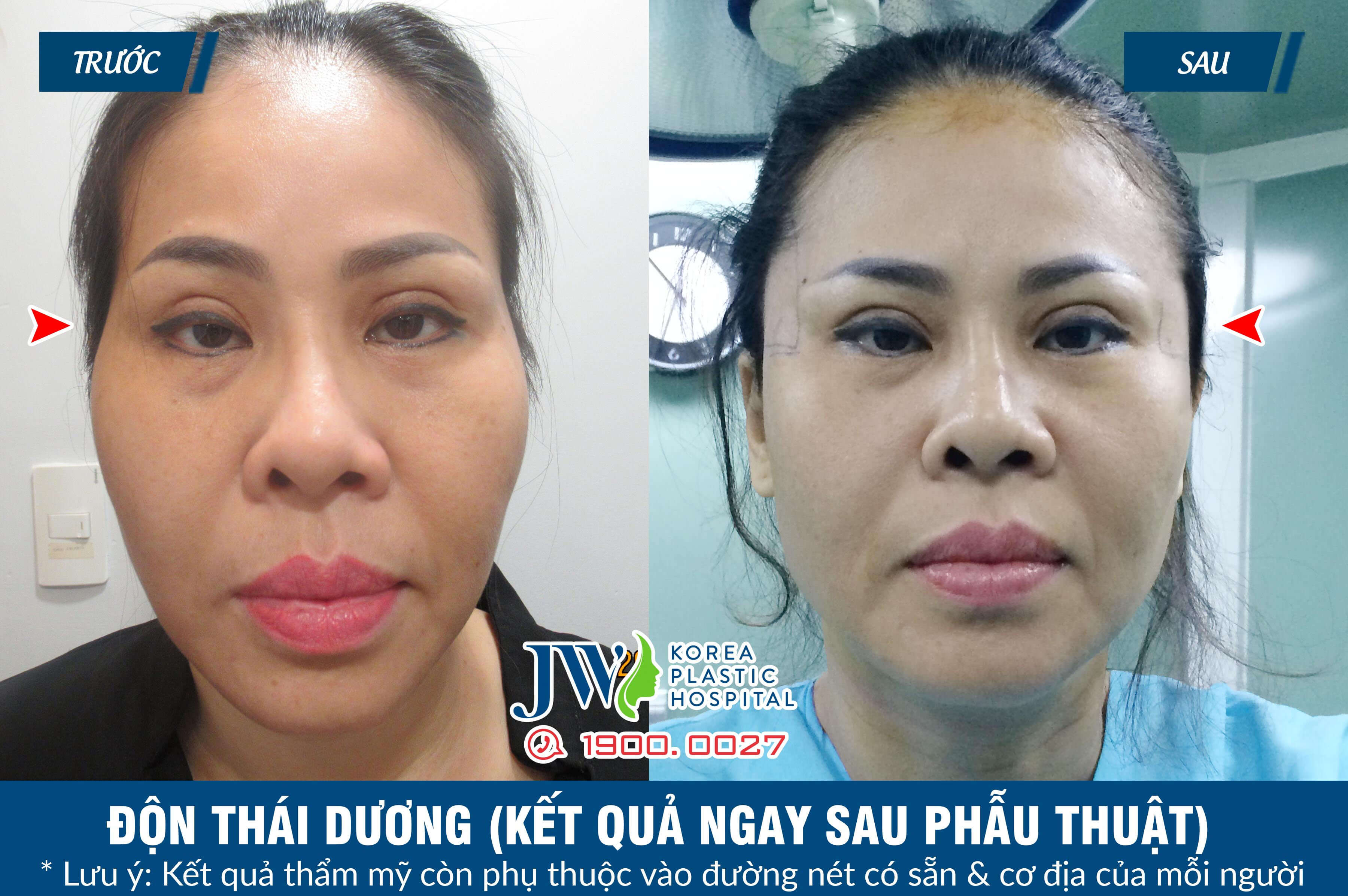 don-thai-duong-5