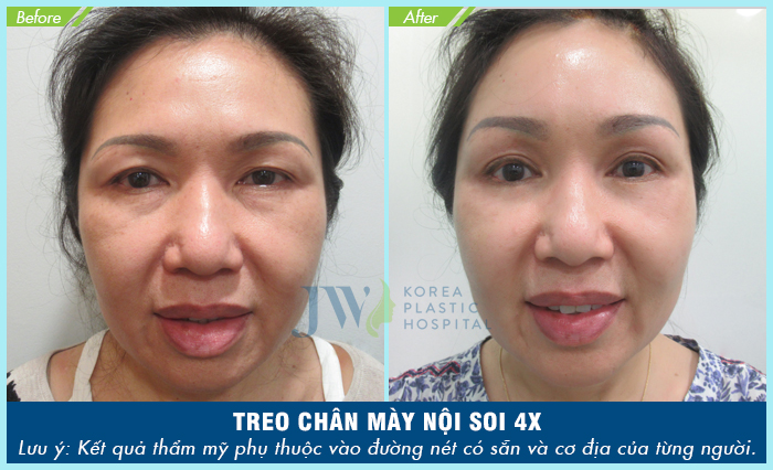 treo-chan-may-5