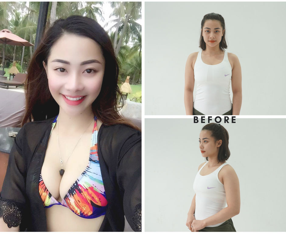 Vòng một “xuống cấp” vì giảm cân đột ngột