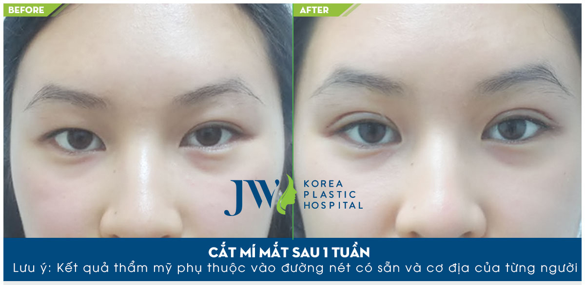 cat-mi-mat-han-quoc-3
