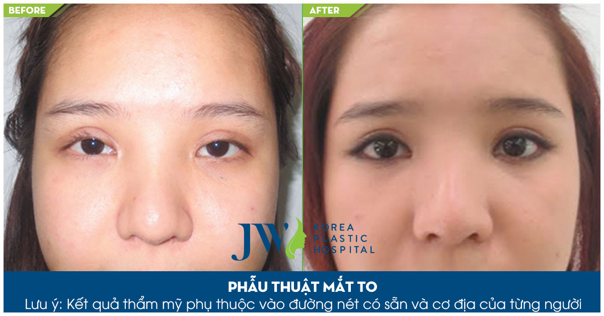 nhung-cach-tao-mat-2-mi-tu-nhien-hieu-qua-nhat-11