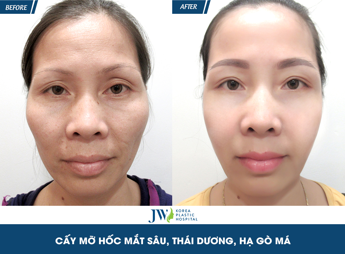 2-10