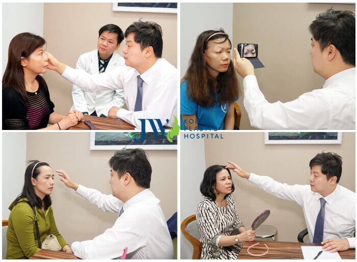 Nhấn mí mắt là gì - Nhấn mí mắt giữ được bao lâu - Điều quan trọng cần biết - Ảnh 10