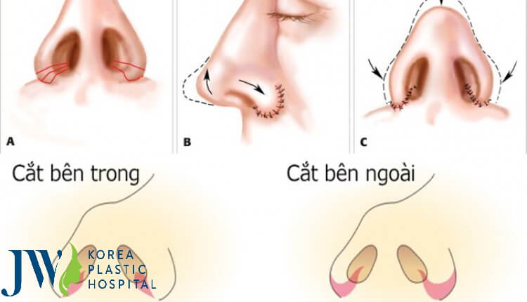 Thu Gọn Cánh Đẹp Thanh Tú Công Nghệ Chuẩn Hàn - Ảnh 2