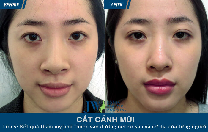 Thu Gọn Cánh Đẹp Thanh Tú Công Nghệ Chuẩn Hàn - Ảnh 8