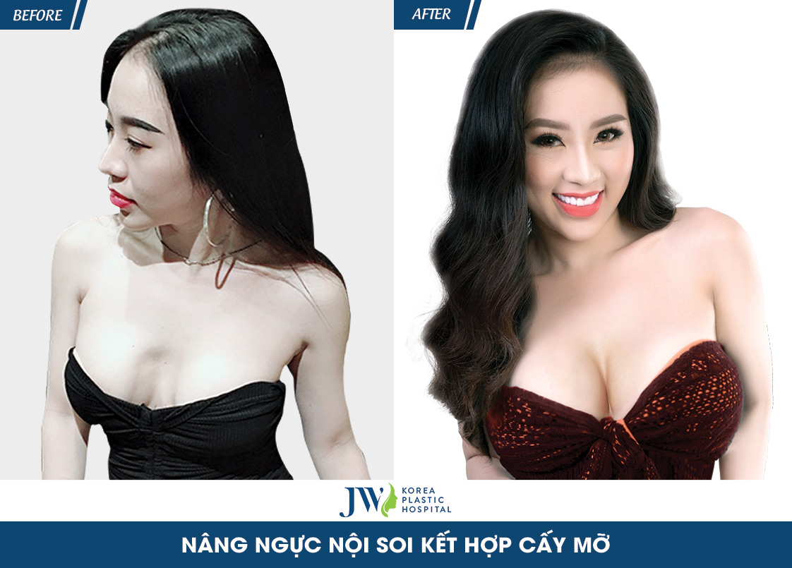 dj-nhung1