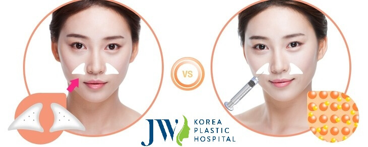 Độn rãnh mũi má tôn tạo nụ cười duyên dáng chỉ 45 phút - Ảnh 2