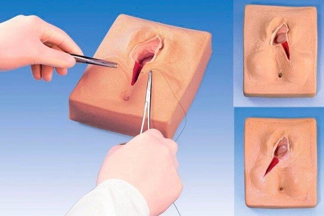 Thẩm mỹ làm đẹp vùng kín - Bí quyết giữ lửa tình yêu - Ảnh 7