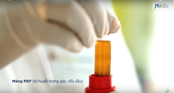 Niềng răng có hết hô hàm không – 5 điều quan trọng cần biết-hình 6
