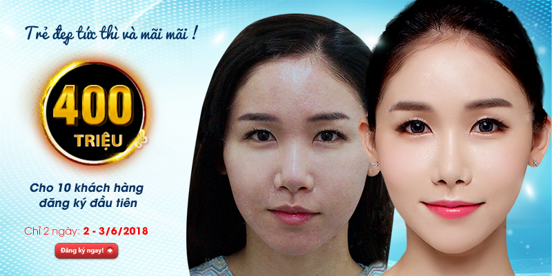 Cấy mỡ với chuyên gia Hàn Quốc - Ưu đãi lên đến 400 triệu đồng