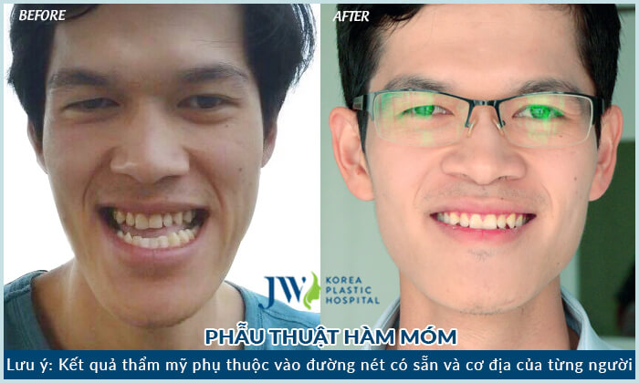 thuc-6