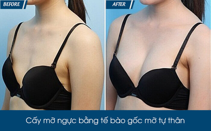 JW thành lập Chuyên khoa cấy mỡ tự thân đầu tiên tại Việt Nam - Ảnh 9