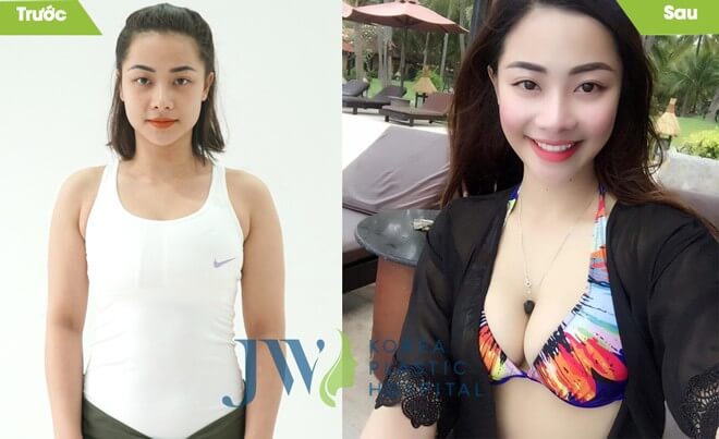 6 sự thực về ngực chảy xệ có thể bạn chưa biết - ảnh 5