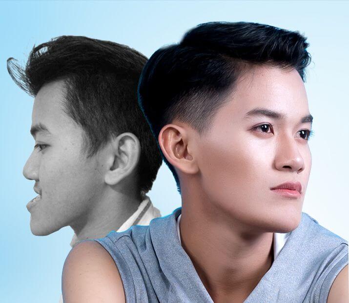 Bệnh viện thẩm mỹ uy tín ở Sài Gòn - Bệnh viện JW Hàn Quốc - Ảnh 5