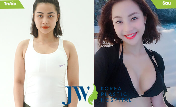 Bệnh viện thẩm mỹ uy tín ở Sài Gòn - Bệnh viện JW Hàn Quốc - Ảnh 9