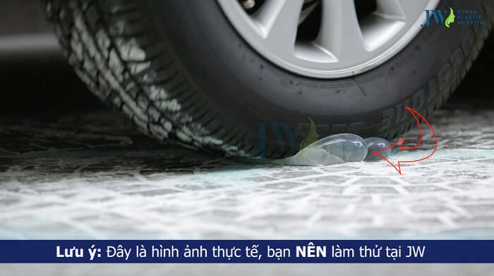 Phẫu thuật nâng ngực có ảnh hưởng gì không-Hình 7