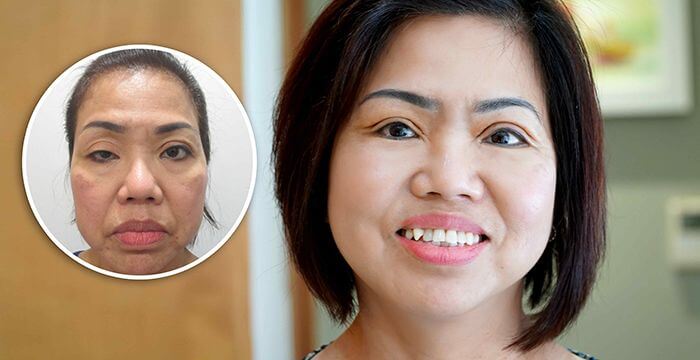 Bệnh viện thẩm mỹ uy tín ở Sài Gòn - Bệnh viện JW Hàn Quốc - Ảnh 7