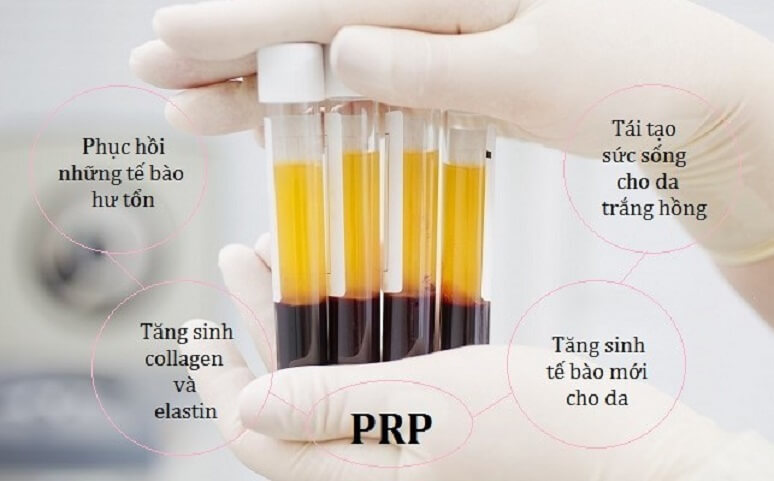 Bác sĩ sửa mũi đẹp nhất Sài Gòn - TS.BS Nguyễn Phan Tú Dung- Ảnh 5