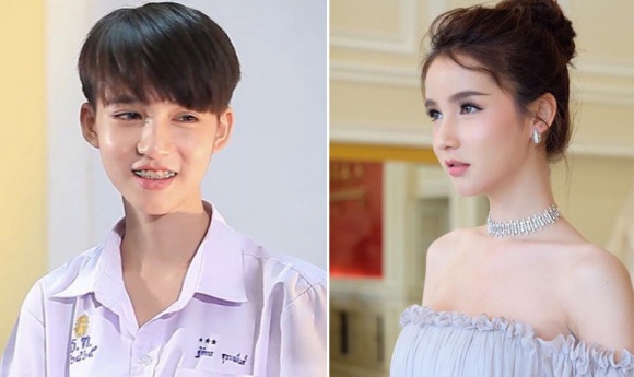 Phẫu thuật chuyển giới từ nam sang nữ như thế nào-hình 3