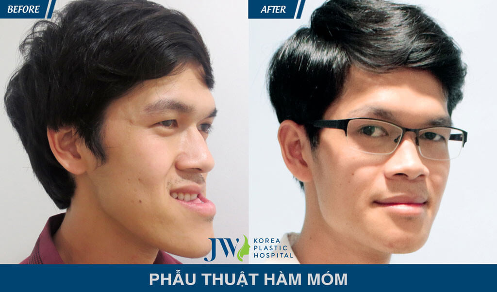 Bệnh viện Thẩm mỹ được mạng xã hội đánh giá cao nhất tại Việt Nam-hình 9