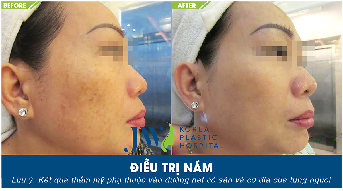 5 tiêu chí nhận diện địa chỉ phẫu thuật thẩm mỹ uy tín-hình 16