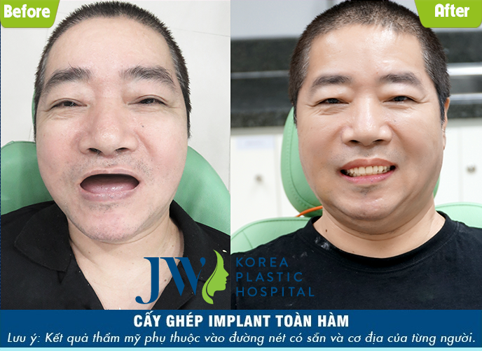 5 tiêu chí nhận diện địa chỉ phẫu thuật thẩm mỹ uy tín-hình 14