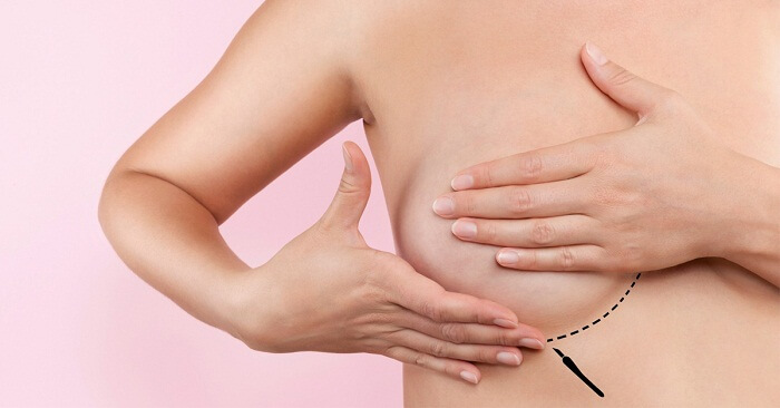 Ngực chảy xệ sau sinh phải làm sao?_4