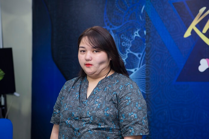 Cô gái “khuyết nửa gương mặt” bất ngờ được hỗ trợ 500 triệu để phẫu thuật tại Hàn Quốc