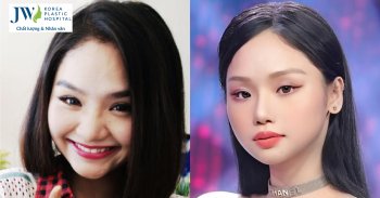 miu lê sửa mũi