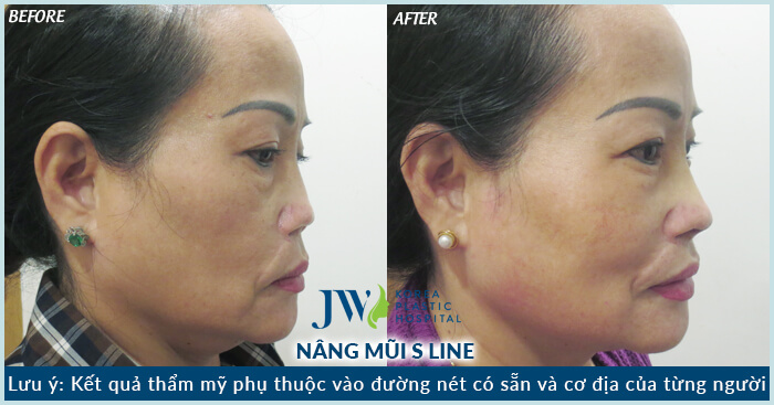 Bệnh viện Thẩm mỹ được mạng xã hội đánh giá cao nhất tại Việt Nam-hình 13