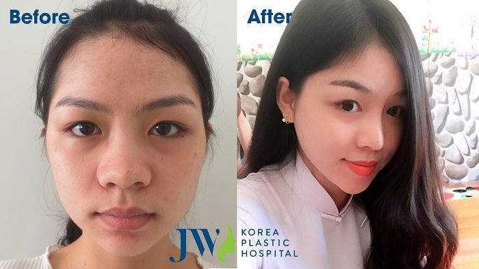 5 tiêu chí nhận diện địa chỉ phẫu thuật thẩm mỹ uy tín-hình 5