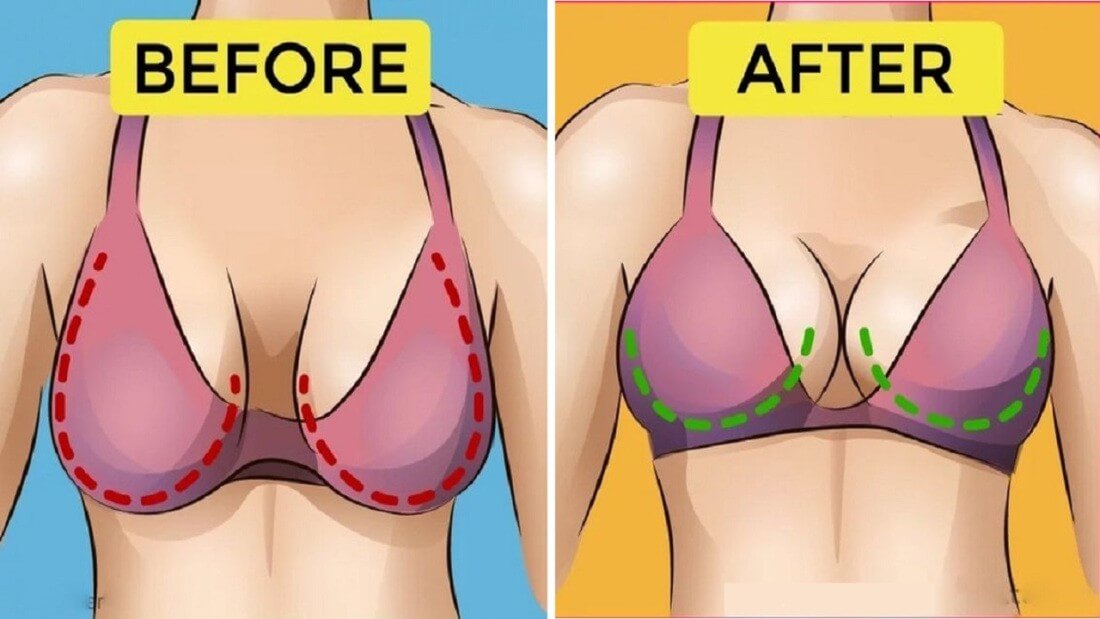 6 sự thực về ngực chảy xệ có thể bạn chưa biết - ảnh 4