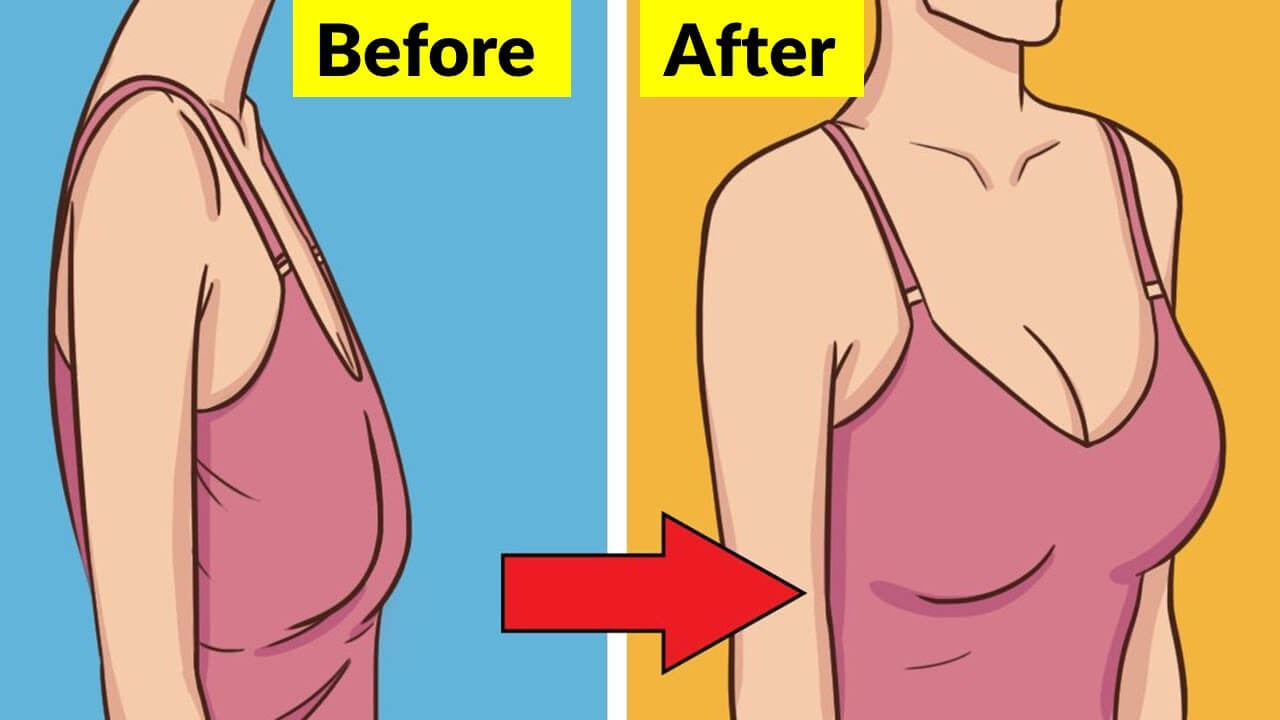 6 sự thực về ngực chảy xệ có thể bạn chưa biết - ảnh 3