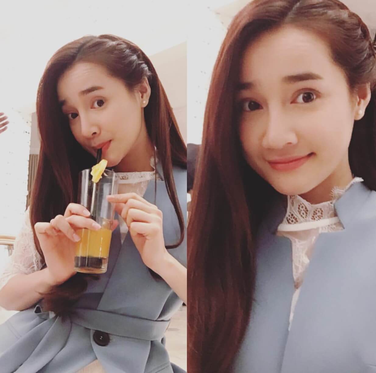 Nhã Phương sửa mũi xinh đẹp hơn bội phần - Ảnh 3