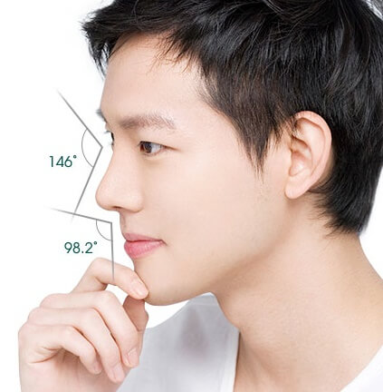 5 điều cần biết về sửa mũi nam an toàn-hình 2