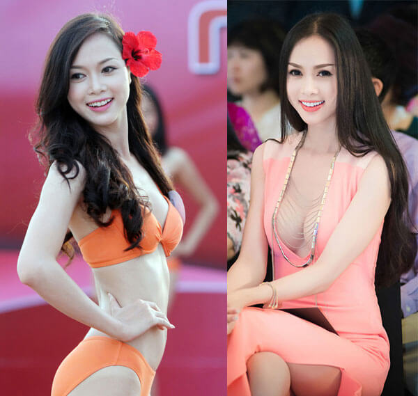 Top 5 những sao Việt phẫu thuật thẩm mỹ vòng 1-hình 6