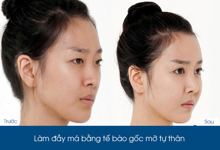 Cấy tế bào gốc là gì, có tác dụng như thế nào-hình 6