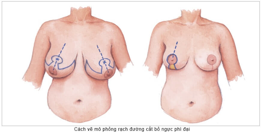 Thu nhỏ vòng 1 ở đâu an toàn và chất lượng-hình 3