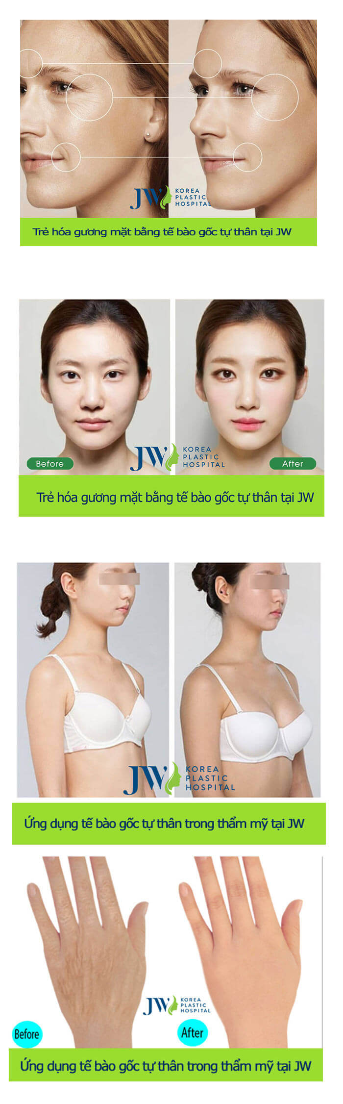 Trẻ hóa da mặt bằng tế bào gốc-hình 6