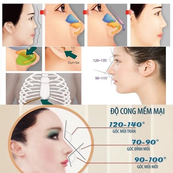 Nâng mũi bằng sụn tự thân được bao lâu - hình 2