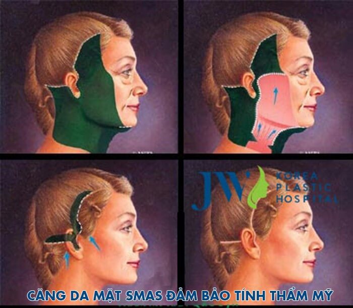Căng da mặt có nguy hiểm không -hình 2