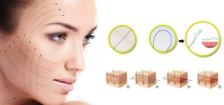 Căng da mặt bằng chỉ sinh học giá bao nhiêu - hình 2