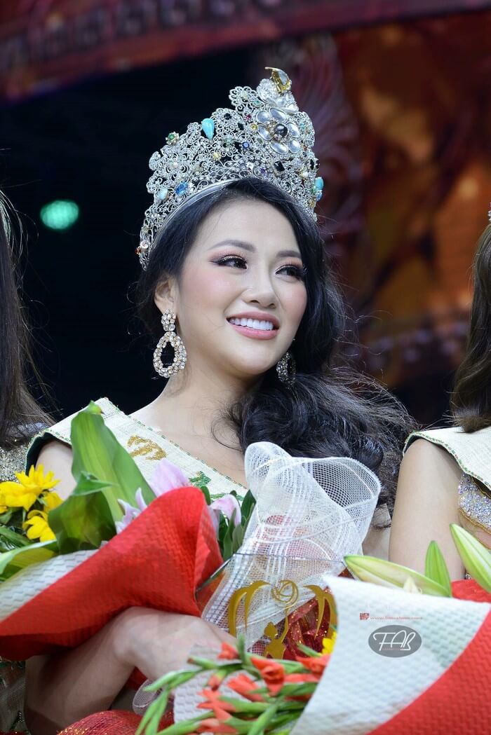 Nguyễn Phương Khanh phẫu thuật thẩm mỹ