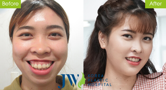 Nhan sắc mới khởi đầu mới 45