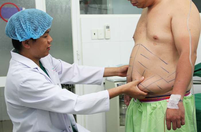 Bác sĩ chuyên khoa trực tiếp thăm khám và tiến hành loại bỏ mỡ thừa ở vùng cần điều trị